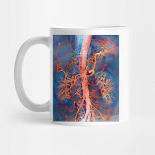 Abdominal arteries, X-ray (P206/0309) Mug